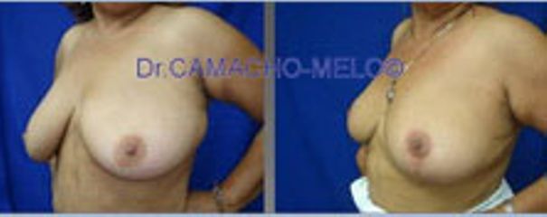 Dr. Camacho Melo