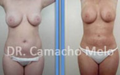 Dr. Camacho Melo