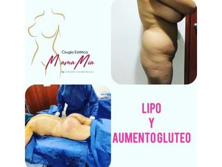 Liposucción - Dr. Rodolfo González Reynoso