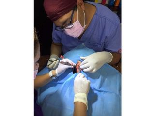 Otoplastia