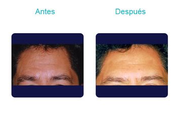 Clínica Dermatológica Y Cirugía Estética De Puebla