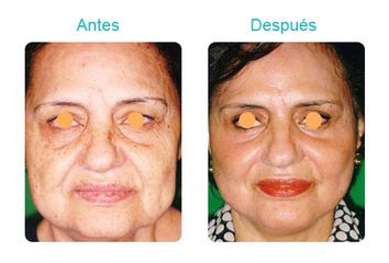 Clínica Dermatológica Y Cirugía Estética De Puebla