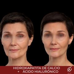 HarmonyCa - Clinica Dermatológica y Cirugía Estética Puebla