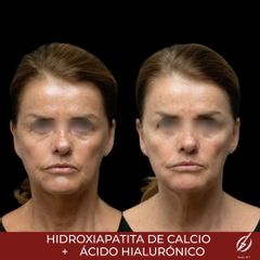 HarmonyCa - Clinica Dermatológica y Cirugía Estética Puebla