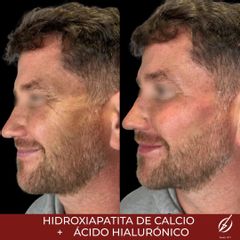 HarmonyCa - Clinica Dermatológica y Cirugía Estética Puebla