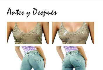 Antes y después de Aumento de busto