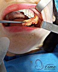 CIME Centro Integral de Cirugía y Medicina Estética