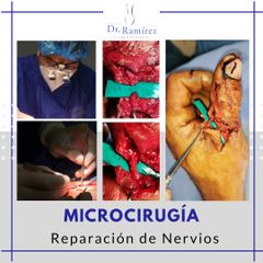 Neurorrafia - Dr. Edgar Ramírez López