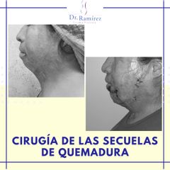 Cirugía reconstructiva -Dr. Edgar Ramírez López