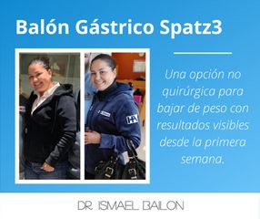 Balón gástrico - Dr. Ismael Bailon