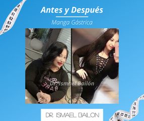 Manga gástrica - Dr. Ismael Bailon