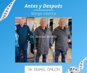 Manga gástrica - Dr. Ismael Bailon