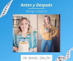 Manga gástrica - Dr. Ismael Bailon