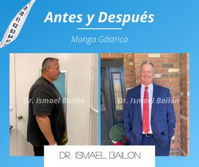 Manga gástrica - Dr. Ismael Bailon