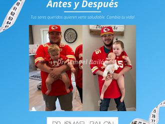 Manga Gástrica antes y después - 790488