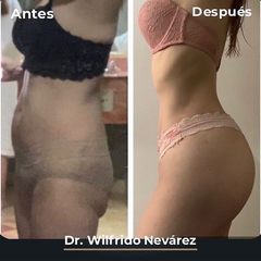 Antes y después