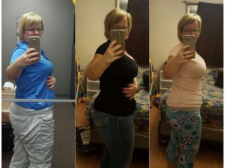 Antes y después de Lipoescultura