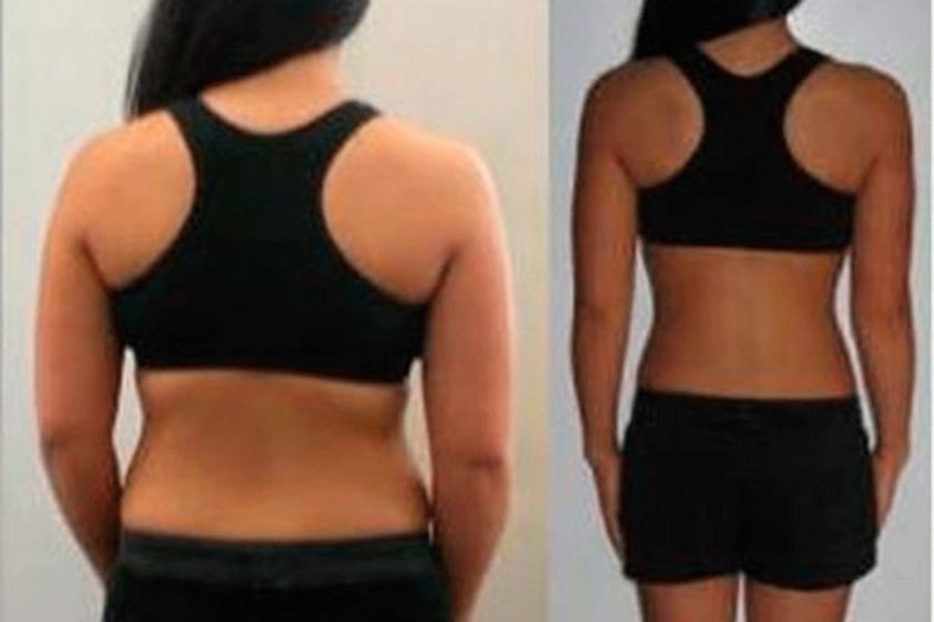 Dieta antes y después - 500916