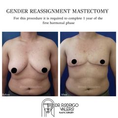 Cambio de sexo - Dr. Rodrigo Valero Jarillo
