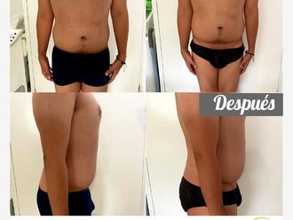 Dieta antes y después - 738036