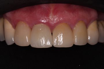 Dentalis Aesthetic