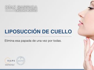 Dr. Julio Cesar Díaz Barriga - Liposucción de Cuello