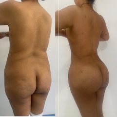LipOkinni