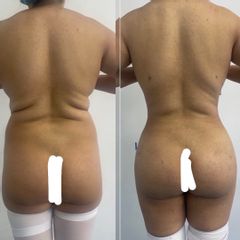 LiPokinni