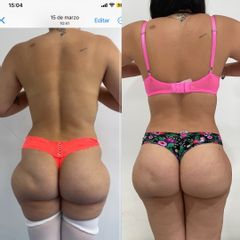 lipokinni