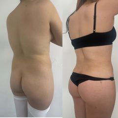 LipoKinni - Dr. José Miguel De la Fuente Coutiño