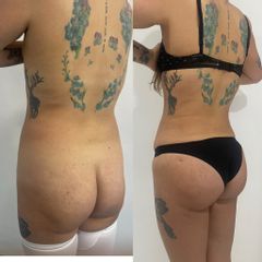 LipoKinni - Dr. José Miguel De la Fuente Coutiño