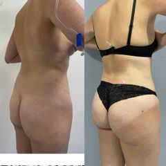 LipoKinni - Dr. José Miguel De la Fuente Coutiño