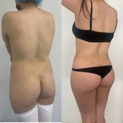 LipoKinni - Dr. José Miguel De la Fuente Coutiño