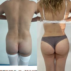 LipoKinni - Dr. José Miguel De la Fuente Coutiño