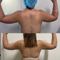 LipoKinni - Dr. José Miguel De la Fuente Coutiño