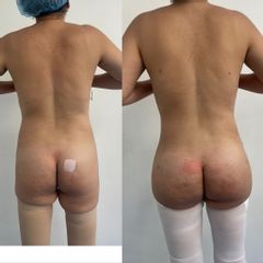 LipoKinni - Dr. José Miguel De la Fuente Coutiño