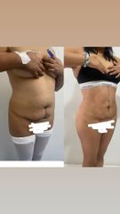 LipoKinni - Dr. José Miguel De la Fuente Coutiño