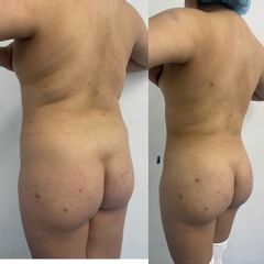 LipoKinni - Dr. José Miguel De la Fuente Coutiño