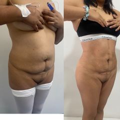 LipoKinni - Dr. José Miguel De la Fuente Coutiño