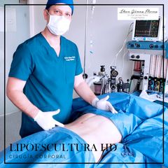 Lipoescultura