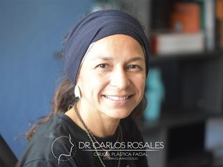 Recuperación de Rinoplastia