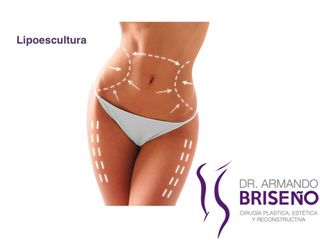 Lipoescultura
