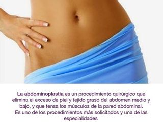 Abdominoplastia