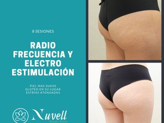 Radiofrecuencia - 855627