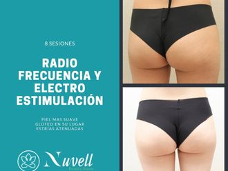 Radiofrecuencia - 855629