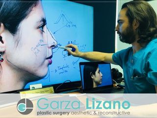 Garza Lizano Plastic Surgery