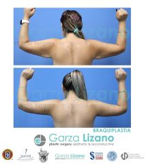 Garza Lizano Plastic Surgery
