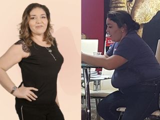 Antes y después de Manga Gástrica