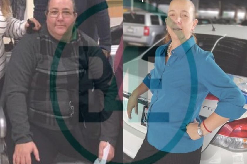 Bypass Gástrico antes y después - 641389