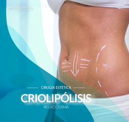 Euroderma